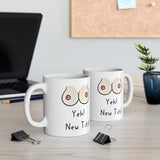 Yeh! New Tits! - Funny & Rude Gift Mug, Cosmetic Breast Surgery Present. Handmade in England