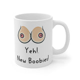 Yeh! New Boobies! - Funny & Rude Gift Mug, Cosmetic Breast Surgery Present. Handmade in England